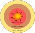 Anatomy of a Blast.svg