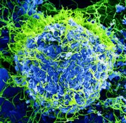 Ebola Virus - Electron Micrograph.tiff