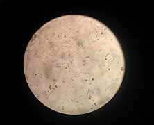 Pond Water Under the Microscope.jpg