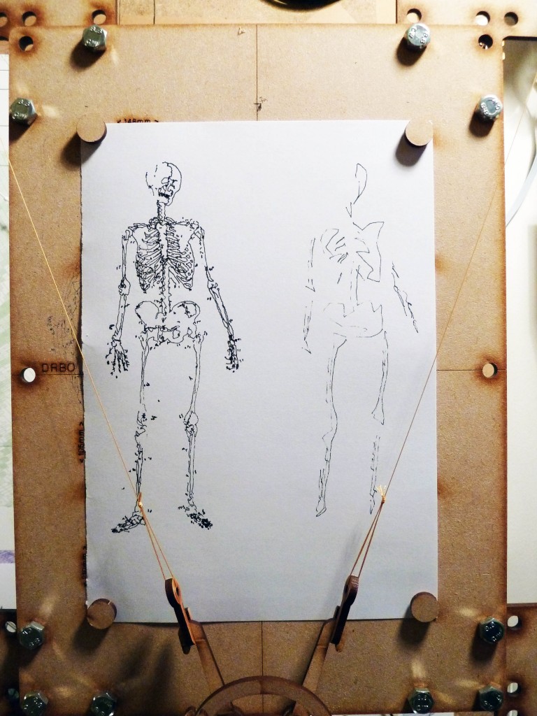 Simple and complicated skeletons